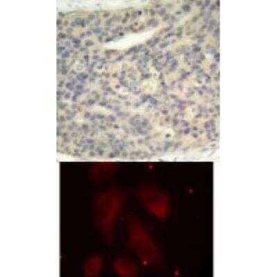 Immunohistochemistry-Paraffin: LIM Kinase 1/2 [p Thr508] Antibody - BSA Free [NBP2-54645]